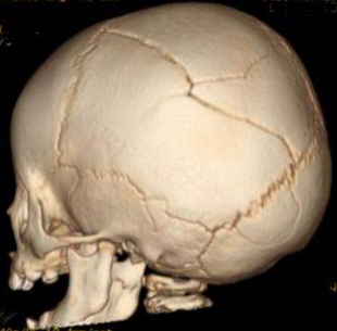 image of skull from left rear quarter